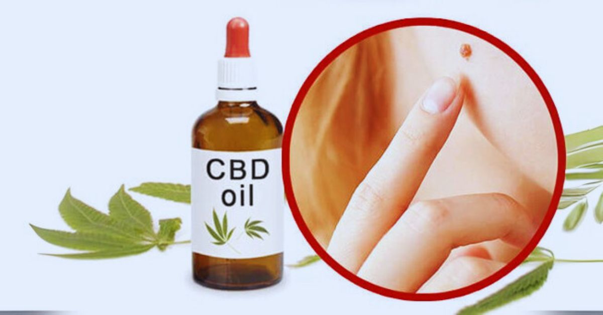 CBD Oil Can Help Dry and Itchy Skin in Cold Season